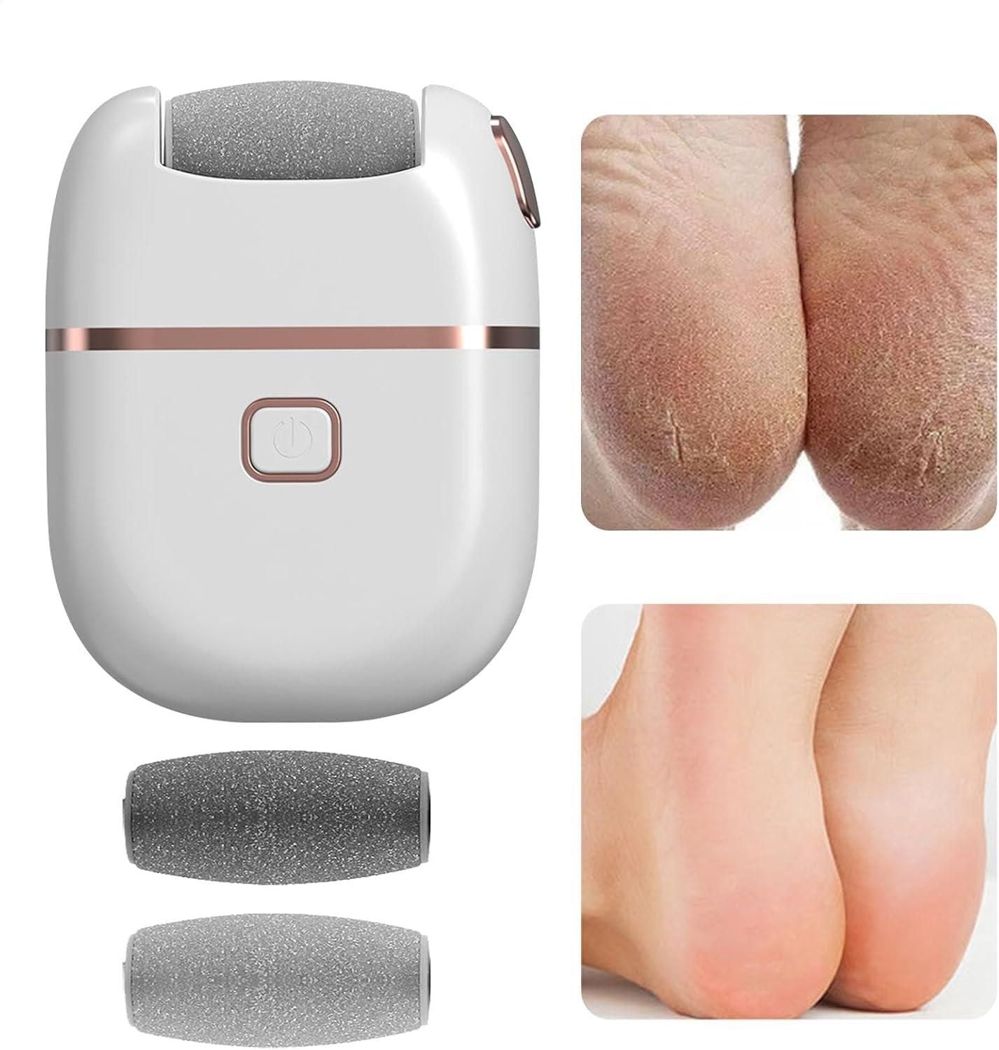 Electronic Pedicure Tool – Rechargeable Foot Callus Remover for Smooth & Soft Feet