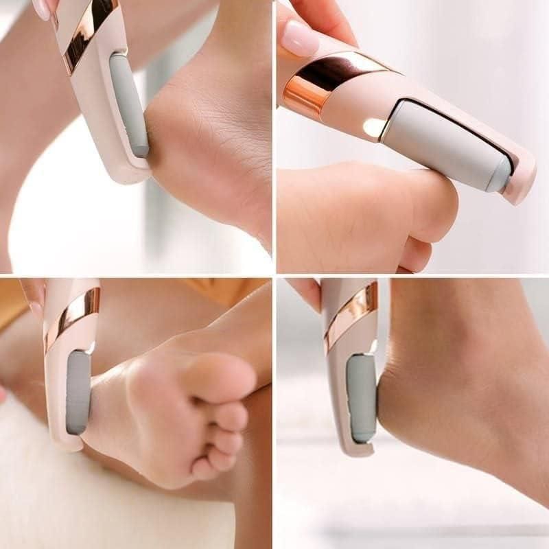 Flawless Pedi™ Electronic Pedicure Tool – Dead Skin & Callus Remover